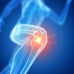 Joy Lane Clinic Whitstable - Treatment for Runner's Knee